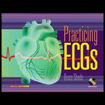 Practicing ECGs   Text Only