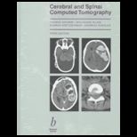 Cerebral and Spinal Computed Tomography