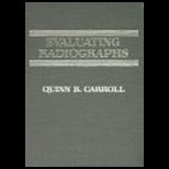 Evaluating Radiographs