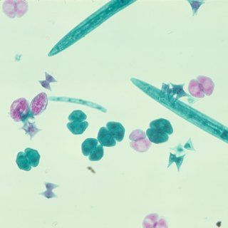 Mixed Desmids, w.m. Microscope Slide