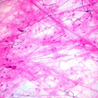 Mammal Areolar Tissue, sec., 7 µm, Verhoeff stain Microscope Slide