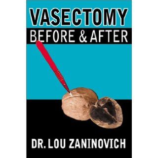 Vasectomy   Before and After Lou Zaninovich 9780741409133 Books