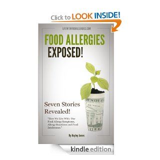 FOOD ALLERGIES EXPOSED "How We Live With Our Food Allergy Symptoms, Allergic Reactions And Food Intolerance". eBook Hayley James Kindle Store