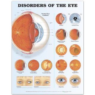 Human Eye Disorders Chart