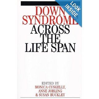 Down Syndrome Across the Life Span M. Cuskelly 9781861562302 Books