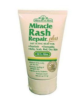Miracle of Aloe Miracle Rash Repair Plus 4 Oz Fast Acting Relief for Psoriasis, Dermatitis, Itchy, Scaly Red, Dry Skin. Promotes Healing of Damaged Skin, All Natural Contains 36% Ultra Aloe, Get the Relief You Need Now Health & Personal Care