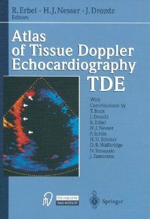 Atlas of Tissue Doppler Echocardiography Tde Raimund Erbel, R. Erbel, H.J. Nesser, J. Drozdz 9783798510203 Books