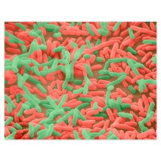 Coloured SEM of Escherichia coli bacteria   5.5 by sciencephotos