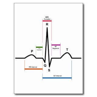 Sinus Rhythm in an Electrocardiogram ECG Diagram Postcards