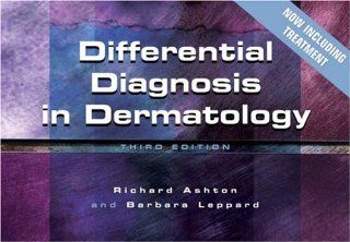 Differential Diagnosis in Dermatology (9781857756609) Richard Ashton, Barbara Leppard Books