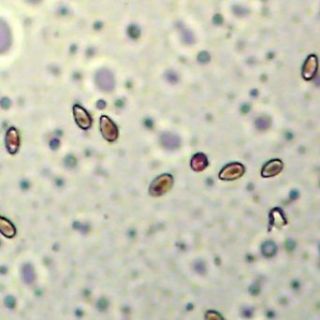 Clonorchis sinensis, c.s. Microscope Slide