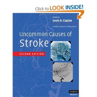 Uncommon Causes of Stroke (9780521874373) Louis R. Caplan, Julien Bogousslavsky Books