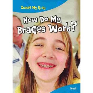How Do My Braces Work? Teeth
